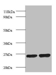 Western blot All lanes: Proteasome subunit beta 1 antibody at 2ug/ml Lane 1: EC109 whole cell lysate Lane 2: 293T whole cell lysate Secondary Goat polyclonal to rabbit IgG at 1/15000 dilution Predicted band size: 27 kDa Observed band size: 27 kDa