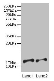 Western blot All lanes: PFDN5 antibody at 2µg/ml Lane 1: EC109 whole cell lysate Lane 2: 293T whole cell lysate Secondary Goat polyclonal to rabbit IgG at 1/15000 dilution Predicted band size: 18, 8, 13 kDa Observed band size: 18 kDa