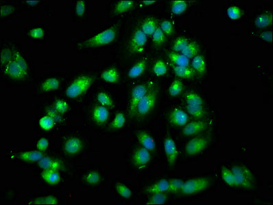 Immunofluorescence staining of Hela cells with CSB-PA01445A0Rb at 1:250, counter-stained with DAPI. The cells were fixed in 4% formaldehyde, permeabilized using 0.2% Triton X-100 and blocked in 10% normal Goat Serum. The cells were then incubated...