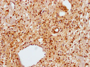 IHC image of CSB-PA014595LA01HU diluted at 1:100 and staining in paraffin-embedded human skin tissue performed on a Leica BondTM system. After dewaxing and hydration, antigen retrieval was mediated by high pressure in a citrate buffer (pH 6.0). Se...