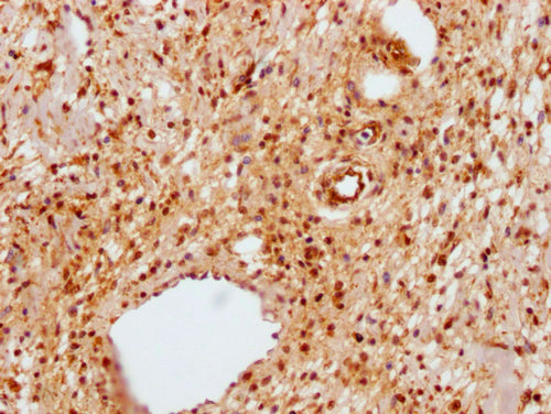 IHC image of CSB-PA014595LA01HU diluted at 1:100 and staining in paraffin-embedded human skin tissue performed on a Leica BondTM system. After dewaxing and hydration, antigen retrieval was mediated by high pressure in a citrate buffer (pH 6.0). Se...
