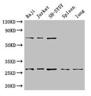 Western Blot Positive WB detected in: Raji whole cell lysate, Jurkat whole cell lysate, SH-SY5Y whole cell lysate, Mouse spleen tissue, Mouse lung tissue All lanes: YWHAZ antibody at 3.4µg/ml Secondary Goat polyclonal to rabbit IgG at 1/50000 dilu...