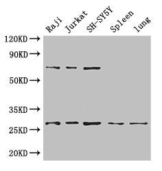Western Blot Positive WB detected in: Raji whole cell lysate, Jurkat whole cell lysate, SH-SY5Y whole cell lysate, Mouse spleen tissue, Mouse lung tissue All lanes: YWHAZ antibody at 3.4µg/ml Secondary Goat polyclonal to rabbit IgG at 1/50000 dilu...