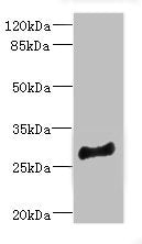 Western blot All lanes: MLF1 antibody at 4.05ug/ml + Mouse brain tissue Secondary Goat polyclonal to rabbit IgG at 1/10000 dilution Predicted band size: 31, 24, 34, 28, 30 kDa Observed band size: 31 kDa