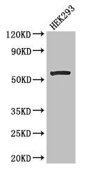 Western Blot Positive WB detected in: HEK293 whole cell lysate All lanes: MLYCD antibody at 2.7µg/ml Secondary Goat polyclonal to rabbit IgG at 1/50000 dilution Predicted band size: 56, 51 kDa Observed band size: 56 kDa