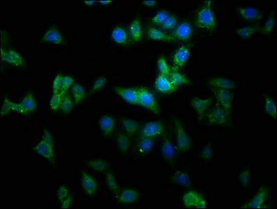 Immunofluorescence staining of HepG2 cells with CSB-PA014655LA01HU at 1:100, counter-stained with DAPI. The cells were fixed in 4% formaldehyde, permeabilized using 0.2% Triton X-100 and blocked in 10% normal Goat Serum. The cells were then incuba...