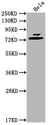 Western Blot Positive WB detected in: Hela whole cell lysate All lanes: Mmp2 antibody at 1:2000 Secondary Goat polyclonal to rabbit IgG at 1/50000 dilution Predicted band size: 75, 66 kDa Observed band size: 75 kDa