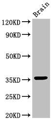 Western Blot Positive WB detected in: Mouse brain tissue All lanes: MNAT1 antibody at 3ug/ml Secondary Goat polyclonal to rabbit IgG at 1/50000 dilution Predicted band size: 36, 32 kDa Observed band size: 36 kDa