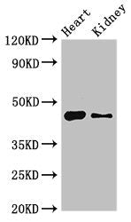 Western Blot Positive WB detected in: Mouse heart tissue, Mouse kidney tissue All lanes: MNDA antibody at 4ug/ml Secondary Goat polyclonal to rabbit IgG at 1/50000 dilution Predicted band size: 46 kDa Observed band size: 46 kDa