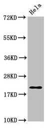 Western Blot Positive WB detected in: Hela whole cell lysate All lanes: MOBP antibody at 4µg/ml Secondary Goat polyclonal to rabbit IgG at 1/50000 dilution Predicted band size: 21, 10, 24 kDa Observed band size: 21 kDa