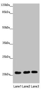 Western blot All lanes: MOCS2 antibody at 1.68 ug/ml Lane 1: A549 whole cell lysate Lane 2: HepG2 whole cell lysate Lane 3: Jurkat whole cell lysate Secondary Goat polyclonal to rabbit IgG at 1/10000 dilution Predicted band size: 21 kDa Observed b...