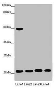 Western blot All lanes: MOCS2 antibody at 0.47 ug/ml Lane 1: A549 whole cell lysate Lane 2: HepG2 whole cell lysate Lane 3: Jurkat whole cell lysate Lane 4: Hela whole cell lysate Secondary Goat polyclonal to rabbit IgG at 1/10000 dilution Predict...