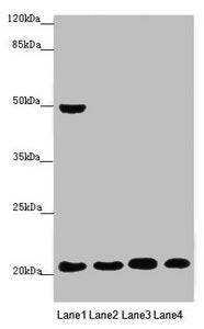 Western blot All lanes: MOCS2 antibody at 0.47 ug/ml Lane 1: A549 whole cell lysate Lane 2: HepG2 whole cell lysate Lane 3: Jurkat whole cell lysate Lane 4: Hela whole cell lysate Secondary Goat polyclonal to rabbit IgG at 1/10000 dilution Predict...