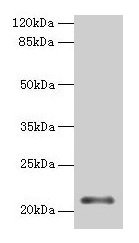 Western blot All lanes: MOCS2 antibody at 2µg/ml + Jurkat whole cell lysate Secondary Goat polyclonal to rabbit IgG at 1/10000 dilution Predicted band size: 21 kDa Observed band size: 21 kDa