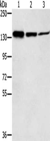 Gel: 6%SDS-PAGE, Lysate: 40 ug, Lane 1-3: Jurkat cells, A172 cells, A549 cells, Primary antibody: CSB-PA014708(SMC2 Antibody) at dilution 1/300, Secondary antibody: Goat anti rabbit IgG at 1/8000 dilution, Exposure time: 20 seconds