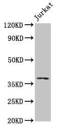 Western Blot Positive WB detected in: Jurkat whole cell lysate All lanes: MOS antibody at 5µg/ml Secondary Goat polyclonal to rabbit IgG at 1/50000 dilution Predicted band size: 38 kDa Observed band size: 38 kDa