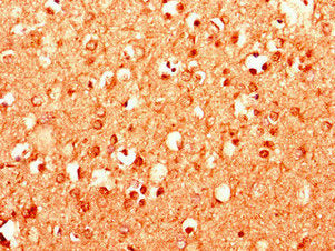 Immunohistochemistry of paraffin-embedded human brain tissue using CSB-PA014744LA01HU at dilution of 1:100