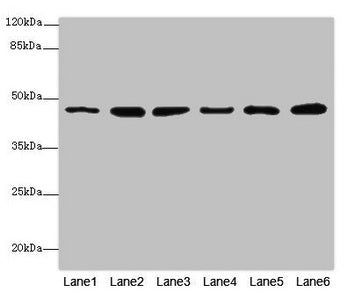 Western blot All lanes: MPI antibody at 5.12µg/ml Lane 1: Mouse heart tissue Lane 2: Mouse kidney tissue Lane 3: Mouse brain tissue Lane 4: HepG2 whole cell lysate Lane 5: 293T whole cell lysate Lane 6: A549 whole cell lysate Secondary Goat polycl...