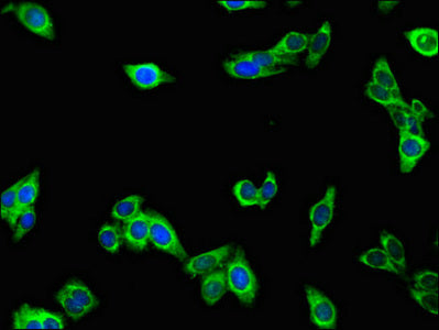 Immunofluorescent analysis of HepG2 cells using CSB-PA014754LA01HU at dilution of 1:100 and Alexa Fluor 488-congugated AffiniPure Goat Anti-Rabbit IgG(H+L)