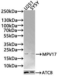 Western Blot Positive WB detected in: U251 whole cell lysate(30µg), SY5Y whole cell lysate(30µg) All lanes: MPV17 antibody at 1:1000 Secondary Goat polyclonal to rabbit IgG at 1/20000 dilution Predicted band size: 20 kDa Observed band size: 20 kDa...