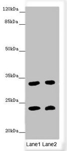 Western blot All lanes: MRAS antibody at 3.44 ug/ml Lane 1: Mouse brain tissue Lane 2: Mouse heart tissue Secondary Goat polyclonal to rabbit IgG at 1/10000 dilution Predicted band size: 24, 16 kDa Observed band size: 24, 32 kDa