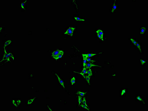 Immunofluorescence staining of MCF-7 cells with CSB-PA014781LA01HU at 1:100, counter-stained with DAPI. The cells were fixed in 4% formaldehyde and blocked in 10% normal Goat Serum. The cells were then incubated with the antibody overnight at 4°C....