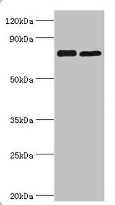 Western blot All lanes: Double-strand break repair protein MRE11A antibody at 8ug/ml Lane 1: 293T whole cell lysate Lane 2: K562 whole cell lysate Secondary Goat polyclonal to rabbit IgG at 1/10000 dilution Predicted band size: 81, 78, 82 kDa Obse...