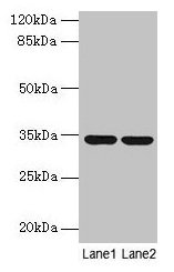 Western blot All lanes: MRPL19 antibody at 2µg/ml Lane 1: MCF-7 whole cell lysate Lane 2: Mouse liver tissue Secondary Goat polyclonal to rabbit IgG at 1/10000 dilution Predicted band size: 34 kDa Observed band size: 34 kDa