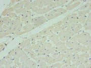 Immunohistochemistry of paraffin-embedded human heart tissue using CSB-PA014839LA01HU at dilution of 1:100
