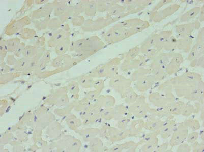 Immunohistochemistry of paraffin-embedded human heart tissue using CSB-PA014839LA01HU at dilution of 1:100