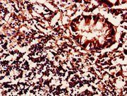 Immunohistochemistry of paraffin-embedded human appendix tissue using CSB-PA014871LA01HU at dilution of 1:100