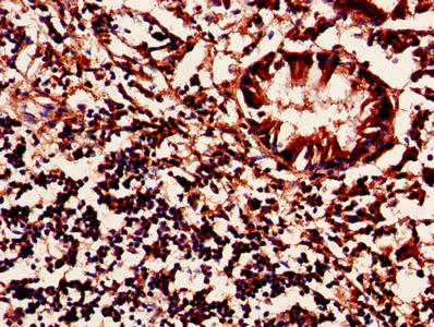 Immunohistochemistry of paraffin-embedded human appendix tissue using CSB-PA014871LA01HU at dilution of 1:100