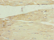 Immunohistochemistry of paraffin-embedded human skeletal muscle tissue using CSB-PA014908ESR1HU at dilution of 1:100