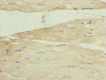 Immunohistochemistry of paraffin-embedded human skeletal muscle tissue using CSB-PA014908ESR1HU at dilution of 1:100