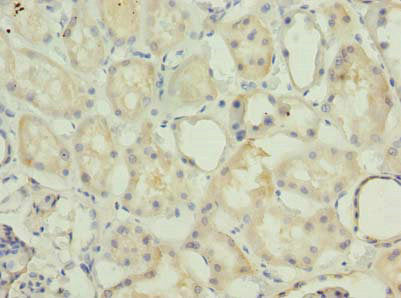 Immunohistochemistry of paraffin-embedded human kidney tissue using CSB-PA014927LA01HU at dilution of 1:100