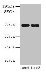 Western blot All lanes: MRPS5 antibody at 5µg/ml Lane 1: Hela whole cell lysate Lane 2: Jurkat whole cell lysate Secondary Goat polyclonal to rabbit IgG at 1/10000 dilution Predicted band size: 49, 28 kDa Observed band size: 49 kDa