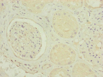 Immunohistochemistry of paraffin-embedded human kidney tissue using CSB-PA014937ESR1HU at dilution of 1:100