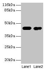 Western blot All lanes: CKB antibody at 2µg/ml Lane 1: Mouse brain tissue Lane 2: 293T whole cell lysate Secondary Goat polyclonal to rabbit IgG at 1/10000 dilution Predicted band size: 43 kDa Observed band size: 43 kDa