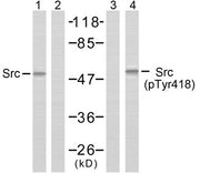 Western blot analysis of extracts from COLO205 cells using Src (Ab-418) antibody (Lane 1 and 2) and Src (phospho-Tyr418) antibody (Lane 3 and 4).