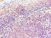 Immunohistochemistry of paraffin-embedded human tonsil tissue using CSB-PA015007DSR2HU at dilution of 1:100