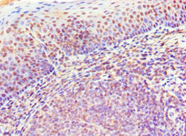 Immunohistochemistry of paraffin-embedded human tonsil tissue using CSB-PA015007DSR2HU at dilution of 1:100