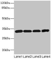Western blot All lanes: Ms4a1 antibody at 4µg/ml Lane 1: Hela whole cell lysate Lane 2: Jurkat whole cell lysate Lane 3: 293T whole cell lysate Lane 4: HL60 whole cell lysate Secondary Goat polyclonal to rabbit IgG at 1/10000 dilution Predicted ba...