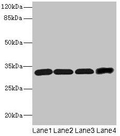 Western blot All lanes: Ms4a1 antibody at 4µg/ml Lane 1: Hela whole cell lysate Lane 2: Jurkat whole cell lysate Lane 3: 293T whole cell lysate Lane 4: HL60 whole cell lysate Secondary Goat polyclonal to rabbit IgG at 1/10000 dilution Predicted ba...