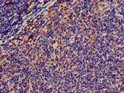 Immunohistochemistry of paraffin-embedded human lymph node tissue using CSB-PA015025LA01HU at dilution of 1:100