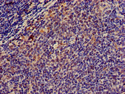 Immunohistochemistry of paraffin-embedded human lymph node tissue using CSB-PA015025LA01HU at dilution of 1:100