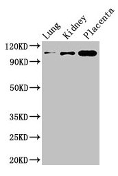 Western Blot Positive WB detected in: Mouse lung tissue, Mouse kidney tissue, Human placenta tissue All lanes: MSH4 antibody at 3µg/ml Secondary Goat polyclonal to rabbit IgG at 1/50000 dilution Predicted band size: 105 kDa Observed band size: 105...