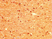 IHC image of CSB-PA015033LA01HU diluted at 1:500 and staining in paraffin-embedded human brain tissue performed on a Leica BondTM system. After dewaxing and hydration, antigen retrieval was mediated by high pressure in a citrate buffer (pH 6.0). S...