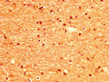IHC image of CSB-PA015033LA01HU diluted at 1:500 and staining in paraffin-embedded human brain tissue performed on a Leica BondTM system. After dewaxing and hydration, antigen retrieval was mediated by high pressure in a citrate buffer (pH 6.0). S...