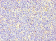 Immunohistochemistry of paraffin-embedded human tonsil tissue using CSB-PA015044ESR2HU at dilution of 1:100