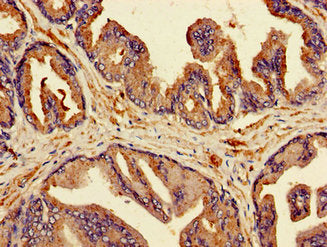 Immunohistochemistry of paraffin-embedded human prostate tissue using CSB-PA015046LA01HU at dilution of 1:100